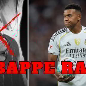 Mbappe rage as Real Madrid doctors use free AI - and scan wrong knee