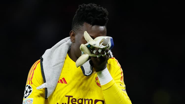 Andre Onana has teeth problems at the start of his Man Utd career