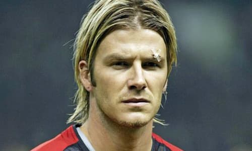 Beckham sporting evidence of Ferguson's rage