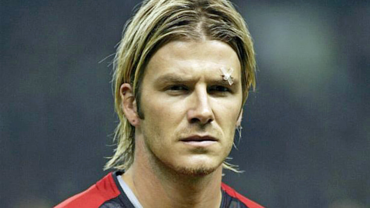 David Beckham sporting evidence of Ferguson's rage