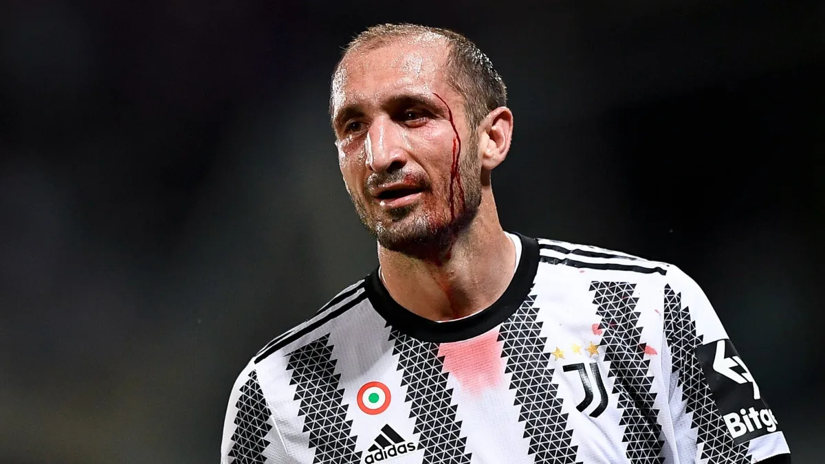 Giorgio Chiellini, Juventus, 2021/22